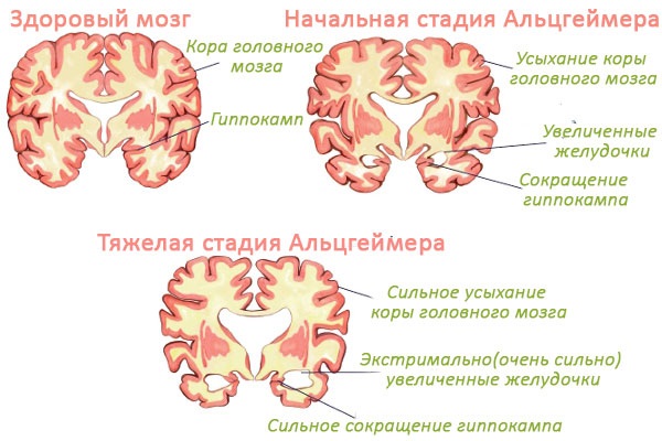 Глутатион - шта је то, користи за тело. Упутства за употребу у козметологији, прегледи лекара