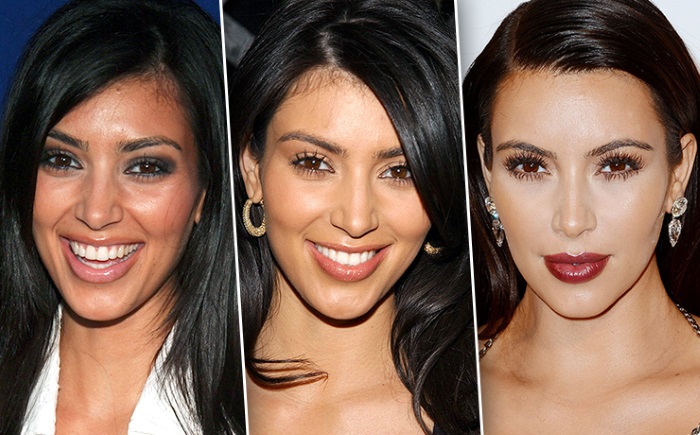 Kim Kardashian. Hình ảnh, phẫu thuật thẩm mỹ, tiểu sử, thông số hình thể, chiều cao và cân nặng. Ngoại hình của bạn thay đổi như thế nào?