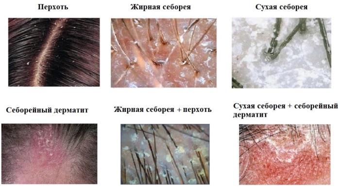 Скин-Цап крема. Упутства за употребу, цена, прегледи, аналоги