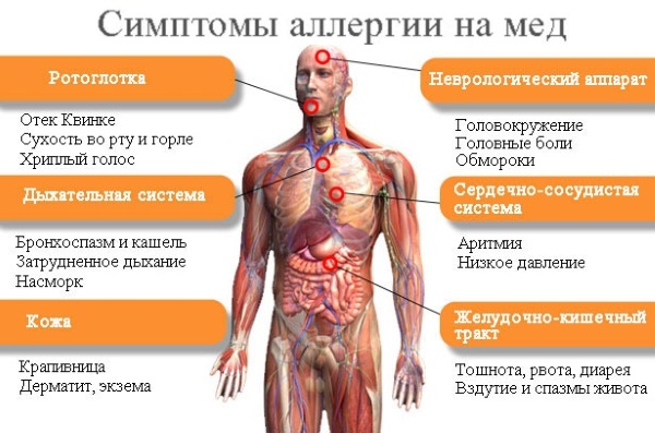 Медена масажа за целулит. Како то учинити исправно за мршављење на стомаку, леђима, ногама, задњици код куће. Видео лекције