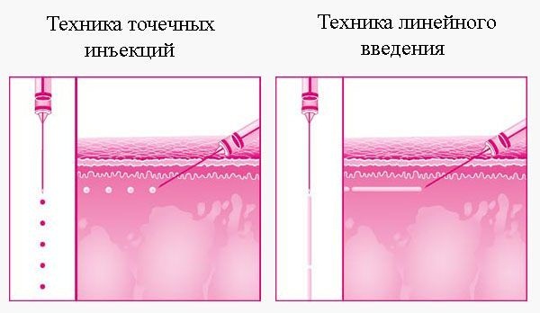 Mesoxanthin trong quy trình hồi sinh sinh học. Hiệu quả của ứng dụng, đánh giá của các chuyên gia thẩm mỹ, hướng dẫn cách châm chích. Giá thuốc