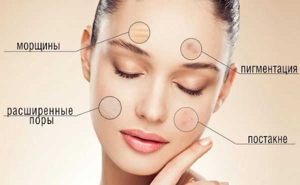 Sữa rửa mặt. Hóa chất Glycolic tốt nhất: Arabia, Compliment, Martinex, Gigi, Holy Land. Nhận xét