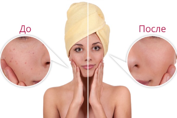 Sữa rửa mặt. Hóa chất Glycolic tốt nhất: Arabia, Compliment, Martinex, Gigi, Holy Land. Nhận xét