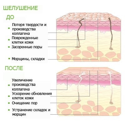 Sữa rửa mặt. Hóa chất Glycolic tốt nhất: Arabia, Compliment, Martinex, Gigi, Holy Land. Nhận xét