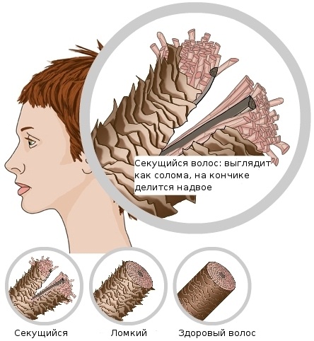 Olaplex cho tóc: nó là gì, đánh giá, điều trị, bảng màu. Cách sử dụng tại nhà, hướng dẫn sử dụng, giá cả, chất tương tự