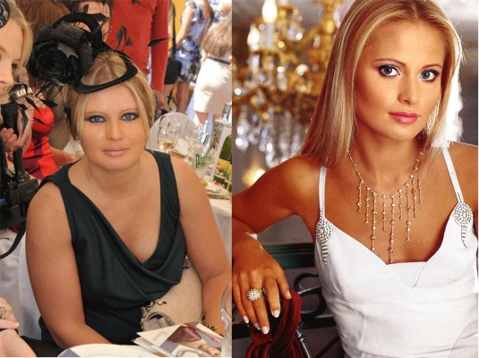Hình ảnh phụ nữ trước và sau khi giảm cân: Gagarina, Chekhova, Kartunkov, Kamenskikh, Afrikantova, Belotserkovskaya và các ngôi sao khác