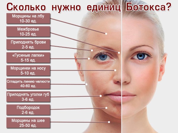 Những điều không nên làm sau khi tiêm botox. Bao lâu bạn có thể không đi ngủ, cúi gập người, uống rượu, kháng sinh, chơi thể thao, tắm nắng, vào nhà tắm, hồ bơi
