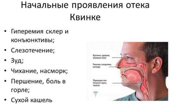 Зиноцап. Упутства за употребу, индикације, контраиндикације, нежељени ефекти. Цена, прегледи, аналоги