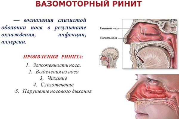 Зиноцап. Упутства за употребу, индикације, контраиндикације, нежељени ефекти. Цена, прегледи, аналоги