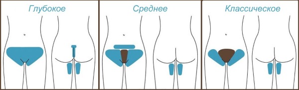 Sáp làm rụng lông hay tạo đường? Diện bikini thâm, chân, nách còn gì tuyệt hơn.
