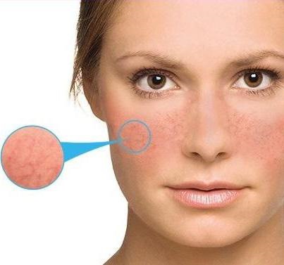 Dược mỹ phẩm, đánh giá mức độ phổ biến: dành cho da có vấn đề, trị mụn, chống lão hóa. Pháp, Nga, nhãn hiệu