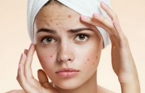 Dược mỹ phẩm, đánh giá mức độ phổ biến: dành cho da có vấn đề, trị mụn, chống lão hóa. Pháp, Nga, nhãn hiệu