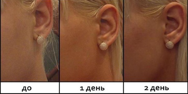 Kem tự nhuộm da tốt nhất cho cơ thể và khuôn mặt. Kem, khăn lau, bình xịt. Nhận xét và giá cả