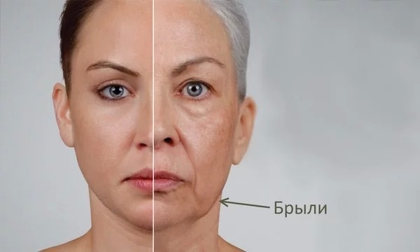 Bọ trên mặt: là gì, làm thế nào để loại bỏ. Tập thể dục, thể thao, massage làm săn chắc vùng kín tại nhà