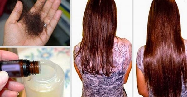 زيت شجرة الشاي الأساسي لعلاج حب الشباب والندوب والكعب go-dereva-ot-pryschey-rubtsov-pyaten-shramov-na-litse-svoystva-i-pн والندوب على الوجه. الخصائص والتطبيق