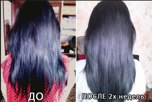 Mẹ để tóc. Tính chất và ứng dụng trong thẩm mỹ, cách thêm vào dầu gội. Nhận xét của các nhà trichologist và bác sĩ da liễu