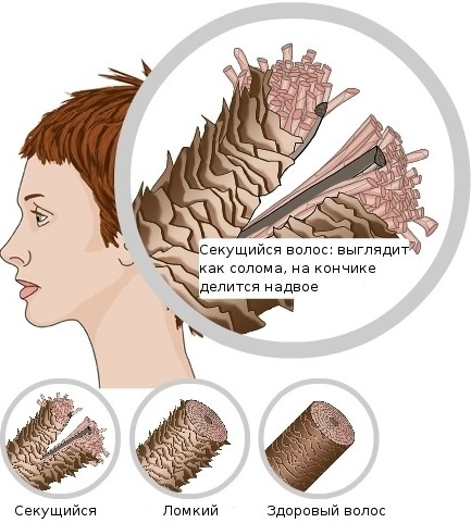 Mẹ để tóc. Tính chất và ứng dụng trong thẩm mỹ, cách thêm vào dầu gội. Nhận xét của các nhà trichologist và bác sĩ da liễu