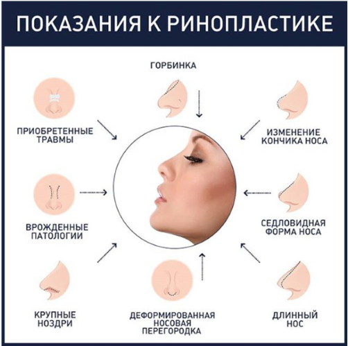 Olga Drozdova trước và sau khi phẫu thuật thẩm mỹ. Ảnh thời trẻ, bây giờ trông như thế nào, nó đã thay đổi như thế nào