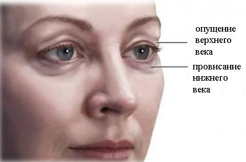 Olga Drozdova trước và sau khi phẫu thuật thẩm mỹ. Ảnh thời trẻ, bây giờ trông như thế nào, nó đã thay đổi như thế nào