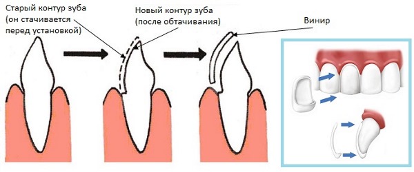 Olga Drozdova trước và sau khi phẫu thuật thẩm mỹ. Ảnh thời trẻ, bây giờ trông như thế nào, nó đã thay đổi như thế nào
