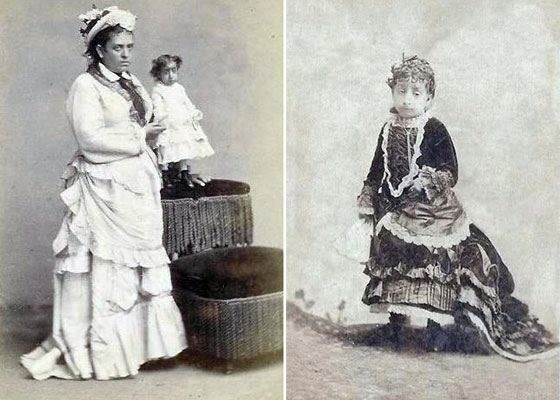 أسوأ شخص في العالم امرأة. فتيات مصابات بفقدان الشهية ونماذج ومشاهير. صورة