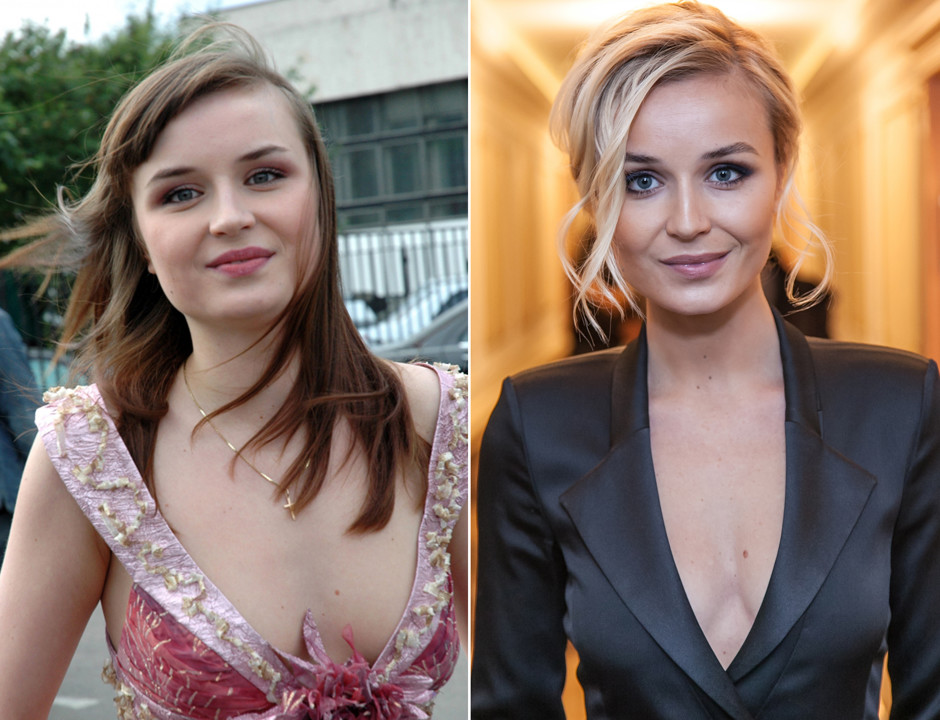 Các ngôi sao trước và sau khi phẫu thuật thẩm mỹ. Ảnh Nga, Hollywood, Hàn Quốc, không thành công, nạn nhân, Instagram, tại nhà 2