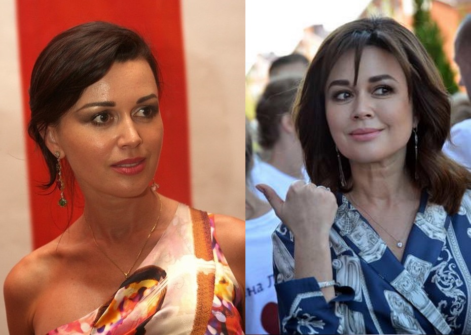 Các ngôi sao trước và sau khi phẫu thuật thẩm mỹ. Ảnh Nga, Hollywood, Hàn Quốc, không thành công, nạn nhân, Instagram, tại nhà 2