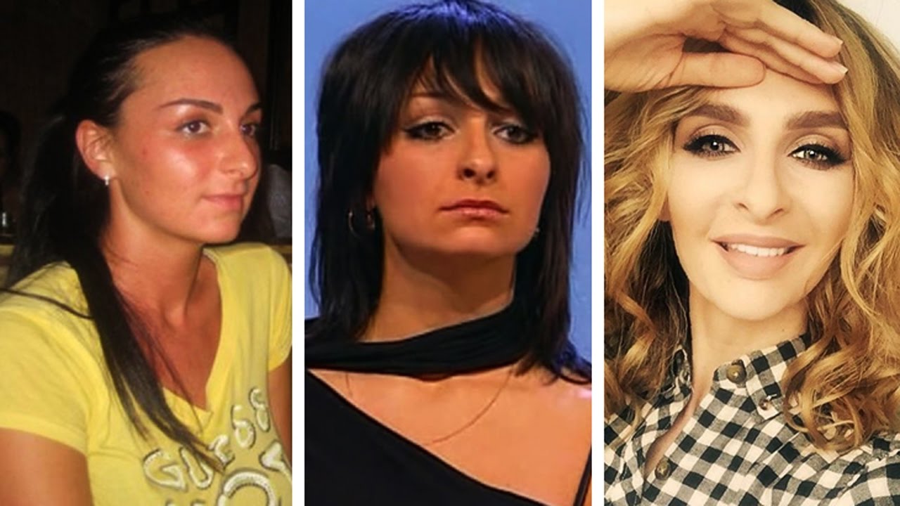 Các ngôi sao trước và sau khi phẫu thuật thẩm mỹ. Ảnh Nga, Hollywood, Hàn Quốc, không thành công, nạn nhân, Instagram, tại nhà 2