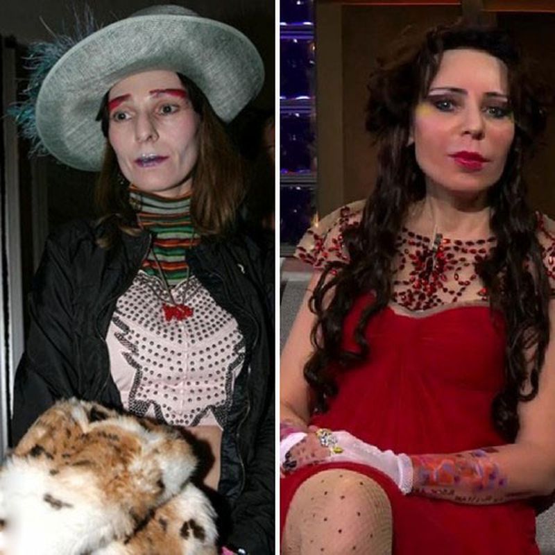 Các ngôi sao trước và sau khi phẫu thuật thẩm mỹ. Ảnh Nga, Hollywood, Hàn Quốc, không thành công, nạn nhân, Instagram, tại nhà 2