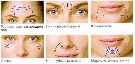 ดึงหน้าแบบไม่ต้องผ่าตัดกับ Margarita Levchenko บทเรียนวิดีโอการฝึกอบรมประโยชน์ของวิธีการ