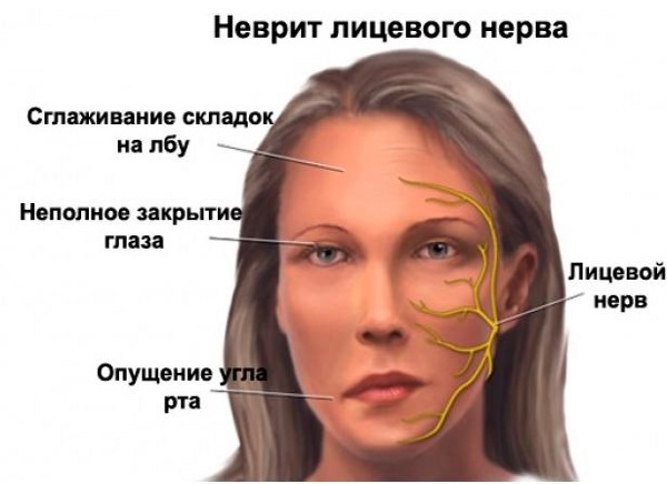 ดึงหน้าแบบไม่ต้องผ่าตัดกับ Margarita Levchenko บทเรียนวิดีโอการฝึกอบรมประโยชน์ของวิธีการ
