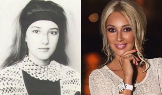 Лера Кудриавтсева. Фотографије пре и после пластичне хирургије, у младости, без шминке, старости, телесних параметара. Како се звезда променила