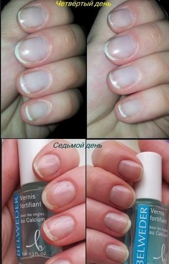 Fortalecimento das unhas em casa com remédios populares, gel, acrílico, pó, sal marinho