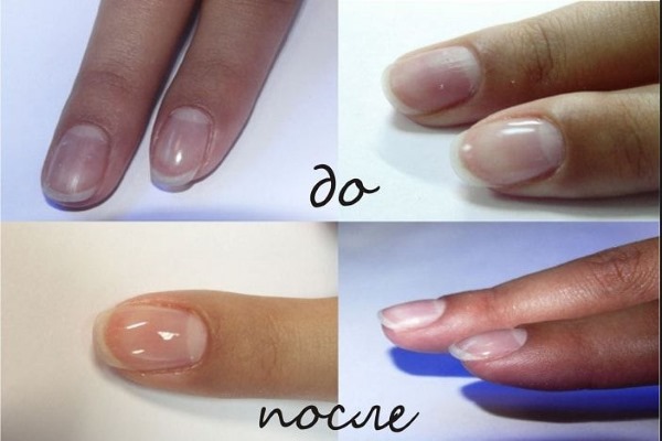 Fortalecimento das unhas em casa com remédios populares, gel, acrílico, pó, sal marinho