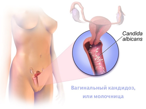 زيت البرغموت. الخصائص والاستخدام في الداخل للوجه والشعر والجلد وحروق الشمس والحمام وحب الشباب والهربس واللمبل والسيلوليت وأمراض النساء والسحر