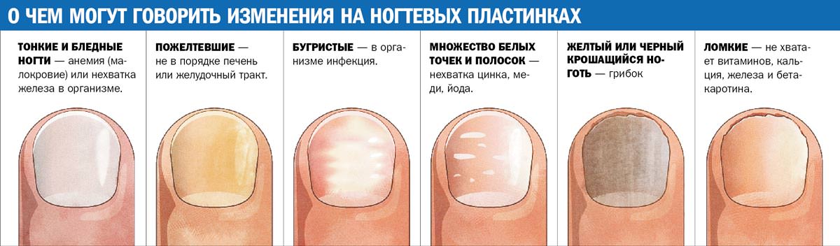 Fortalecimento das unhas em casa com remédios populares, gel, acrílico, pó, sal marinho