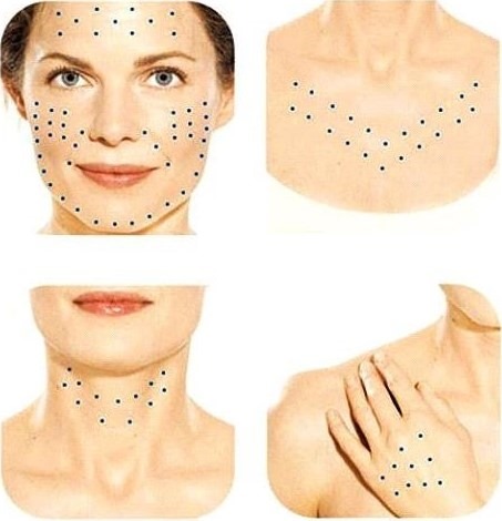 Pengisi restylane, biorevitalisasi. Ulasan. Vital, Perline, Skinbooster untuk pembesaran bibir, di bawah mata. Harga, kecekapan, gambar