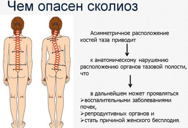 Вежбе обликовања за мршављење код куће. Видео часови фитнеса, вежбе за почетнике, програм тренинга