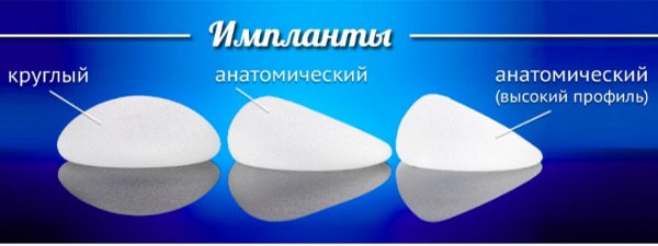 Làm nở ngực. Chi phí tại Moscow, St.Petersburg. Các loại cấy ghép, giá cả