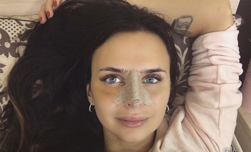 فيكتوريا رومانيتس قبل وبعد الجراحة التجميلية. الصورة ، الوزن والطول ، معلمات الشكل. ما الذي تغير بعد فقدان الوزن والعمليات