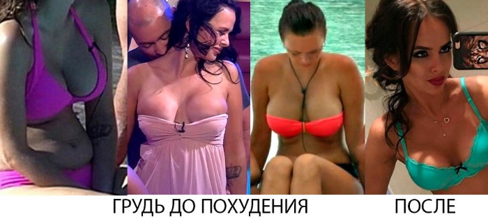 فيكتوريا رومانيتس قبل وبعد الجراحة التجميلية. الصورة ، الوزن والطول ، معلمات الشكل. ما الذي تغير بعد فقدان الوزن والعمليات