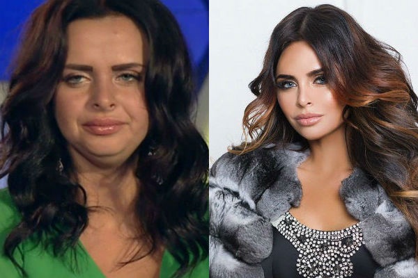 فيكتوريا رومانيتس قبل وبعد الجراحة التجميلية. الصورة ، الوزن والطول ، معلمات الشكل. ما الذي تغير بعد فقدان الوزن والعمليات
