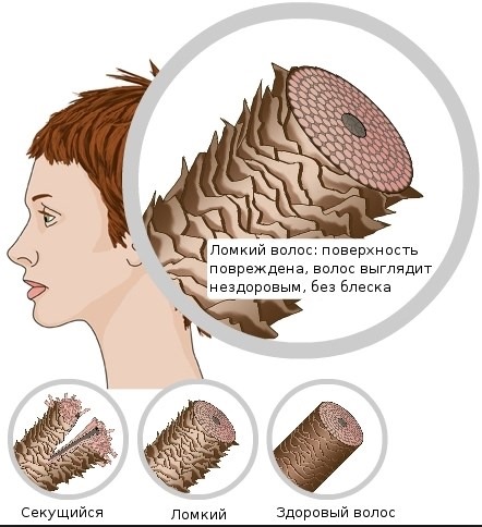 Vitamin dạng ống cho tóc, nicotinic, axit ascorbic, dixon, kerastase. Mặt nạ ở nhà