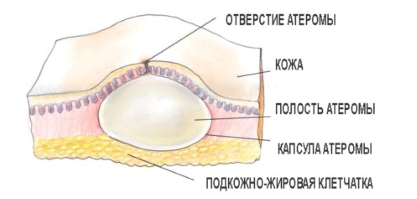 Масти на лицу. Од онога што се појављује, лечење код одраслих лековима, народним лековима, мастом. Како се отарасити код куће
