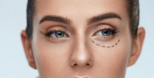 Blepharoplasty. Nhận xét về hoạt động. Ưu nhược điểm của phẫu thuật thẩm mỹ, biến chứng, phục hồi chức năng. Laser, transconjunctival, tròn, tiêm