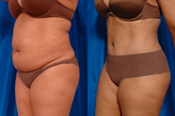 منتديات الجراحة التجميلية. تقييمات الجراحين والعيادات. أسعار العملية