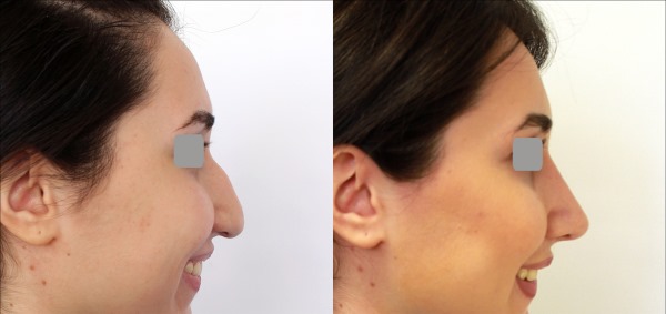 منتديات الجراحة التجميلية. تقييمات الجراحين والعيادات. أسعار العملية