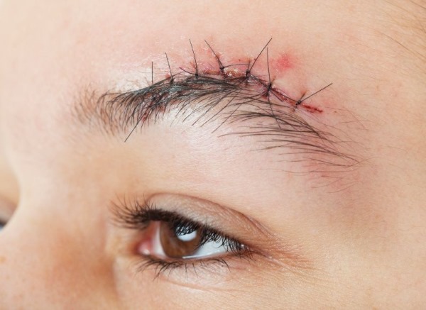 Axit nicotinic cho lông mày và lông mi trong ống thuốc. Ứng dụng, cách sử dụng, hình ảnh, đánh giá
