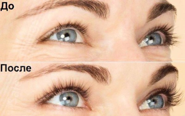 Axit nicotinic cho lông mày và lông mi trong ống thuốc. Ứng dụng, cách sử dụng, hình ảnh, đánh giá