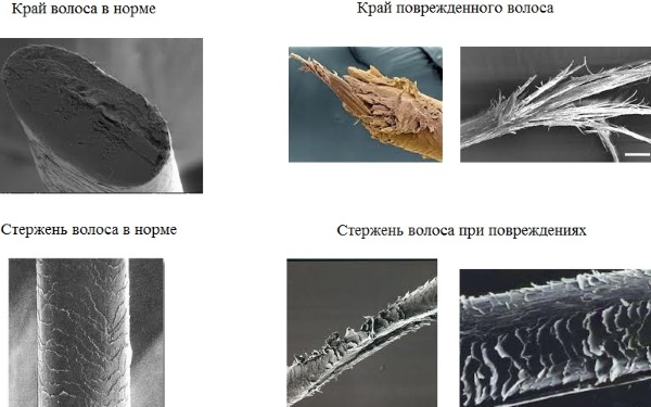 Уље за подељене крајеве, крајеве. Неопходне хранљиве састојке, поврће. Шта купити, пријава